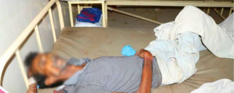 Ants crawl over dead body eyes in Madhya Pradesh