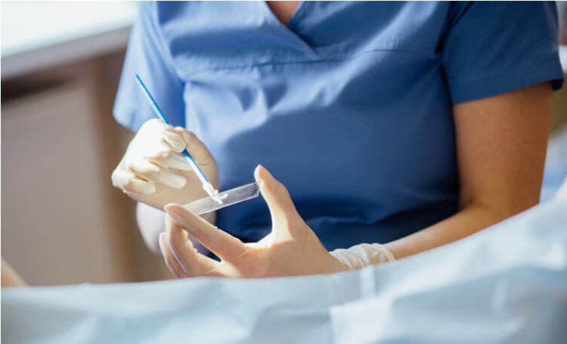  Pap Smear Test