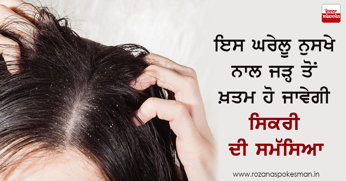 ਸਿਕਰੀ ਨੂੰ ਦੂਰ ਕਰਨ ਦਾ ਘਰੇਲੂ ਉਪਾਅ